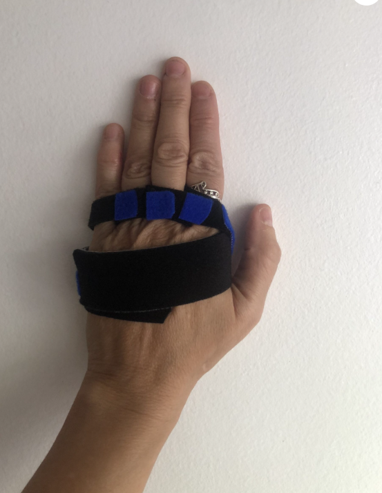 Férula de Rafaga Cubital.