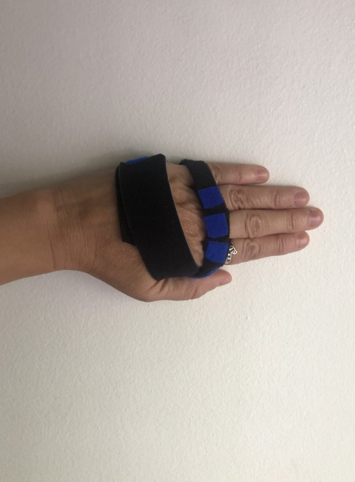 Férula de Rafaga Cubital.