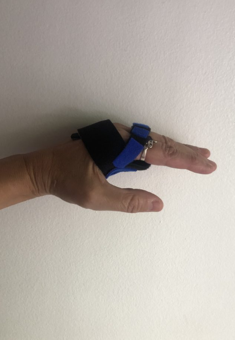 Férula de Rafaga Cubital.